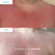 After sun