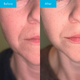 Antioxidant Face Gel & Serum Duo for Protection and Anti-Ageing Action